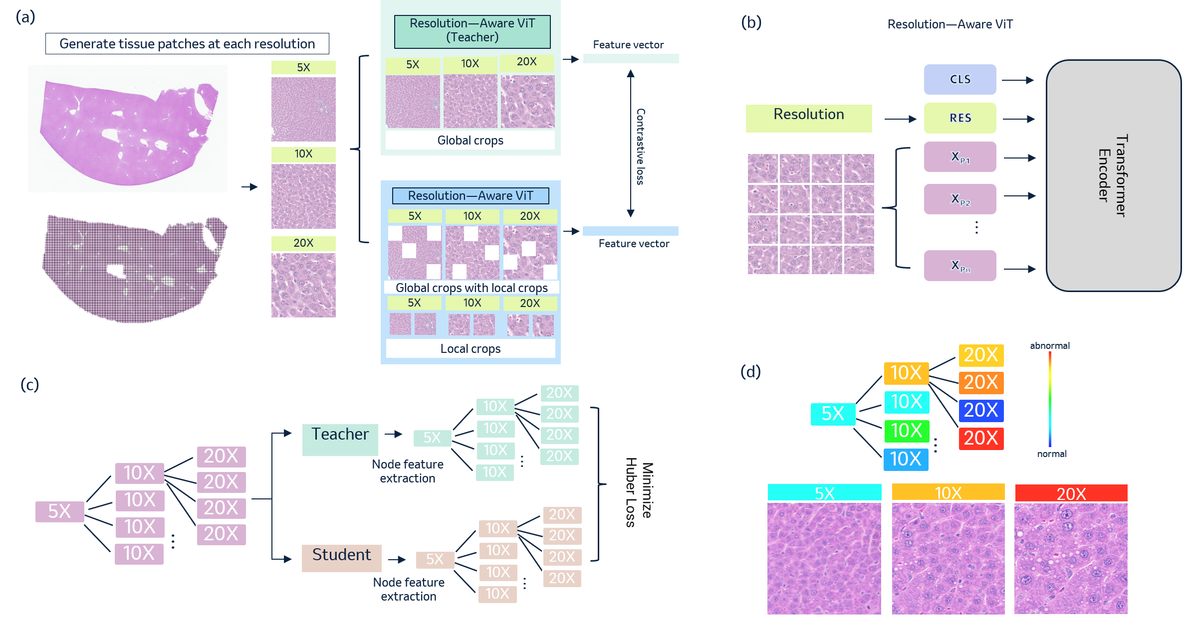 Unsupervised Anomaly Detection on Preclinical Liver H&E Whole Slide ...
